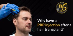 prp-injection-after-hair-transplant